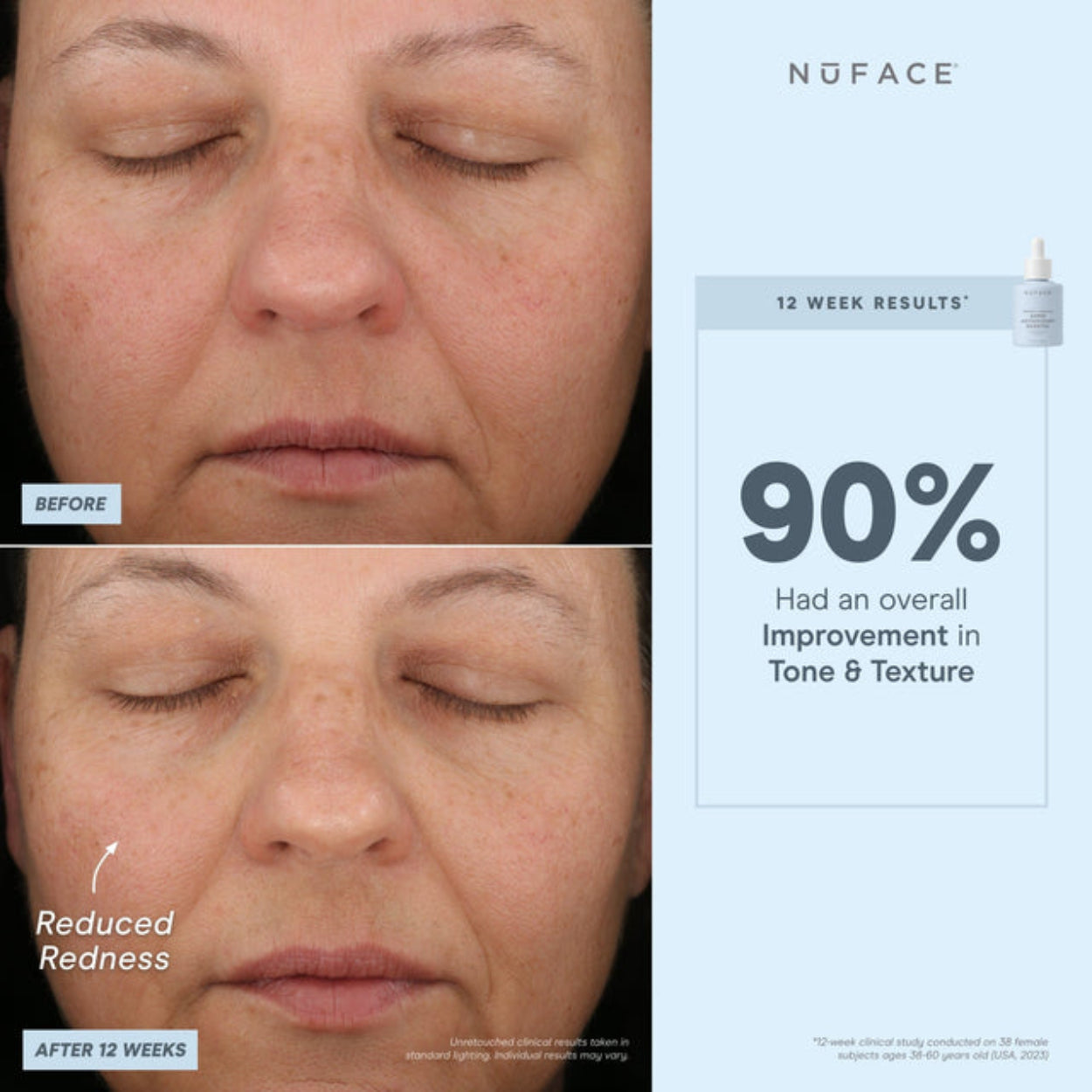 Super Antioxidant Booster Serum Image 7