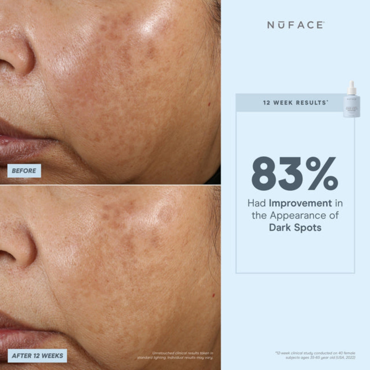 Super Vita C Booster Serum 4