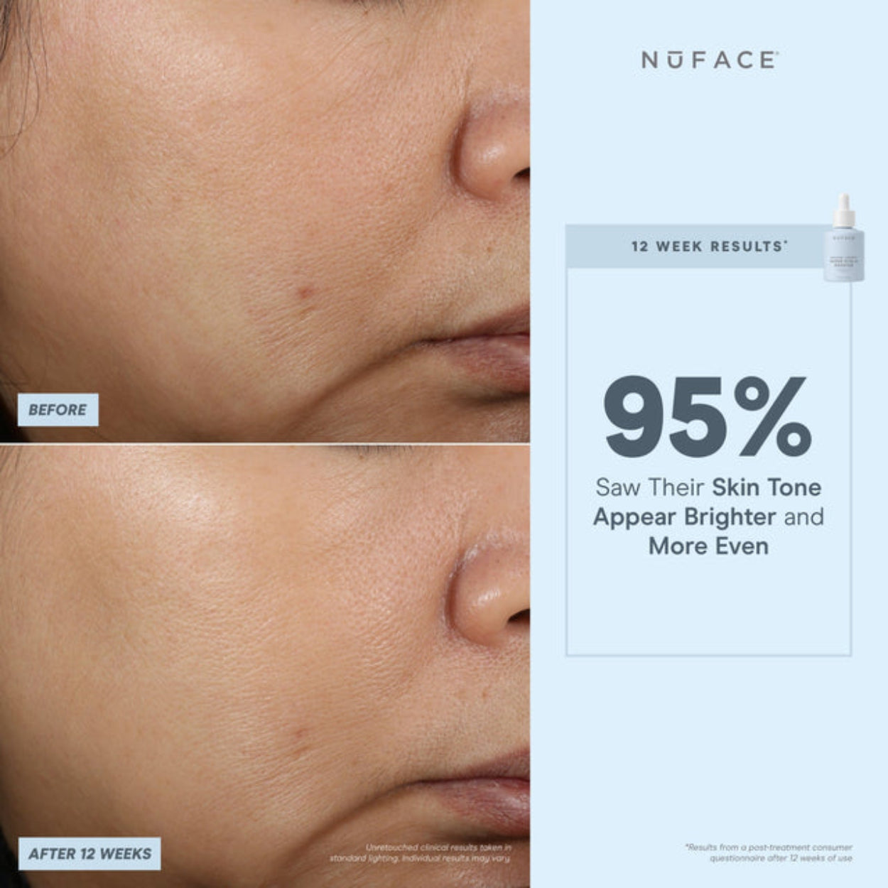 Super Vita C Booster Serum 5