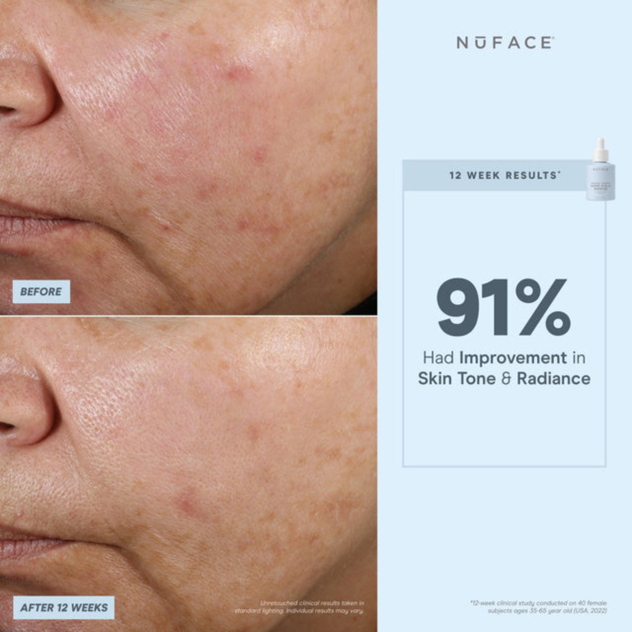 Super Vita C Booster Serum 7