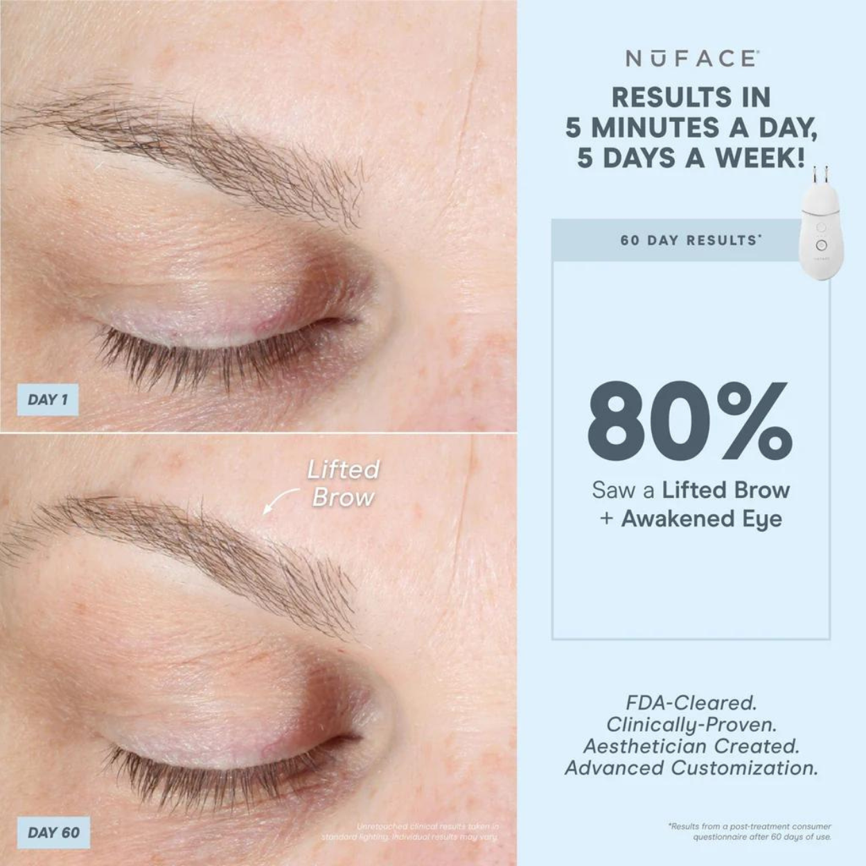 TRINITY+ Effective Lip & Eye Attachment 4