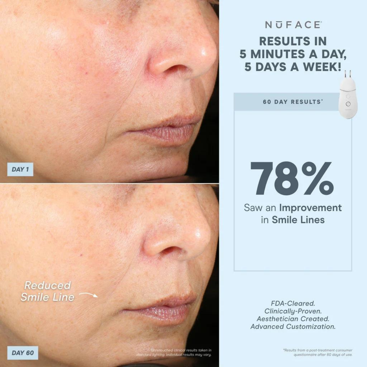 TRINITY+ Effective Lip & Eye Attachment 5