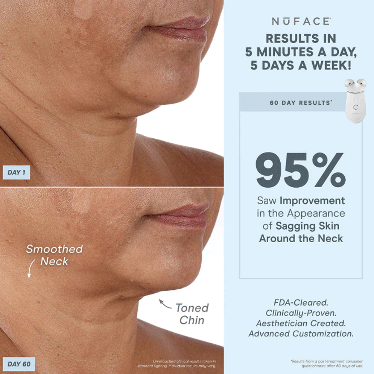 TRINITY+ Wrinkle Reducer Attachment 6