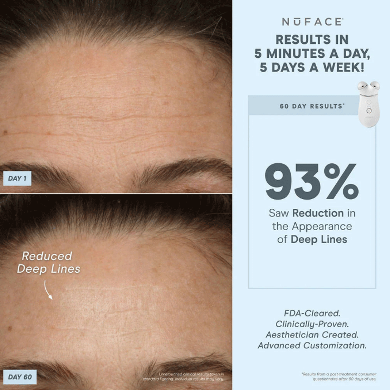 TRINITY+ Wrinkle Reducer Attachment 7
