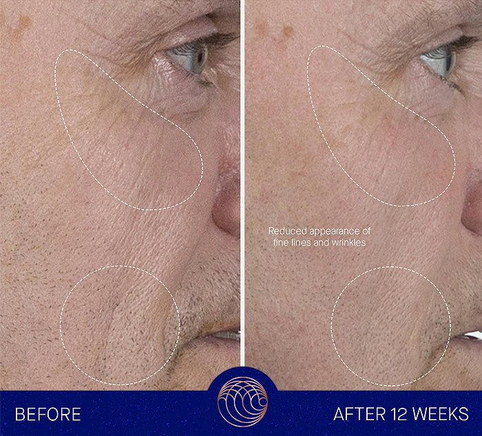 The Serum Result Image