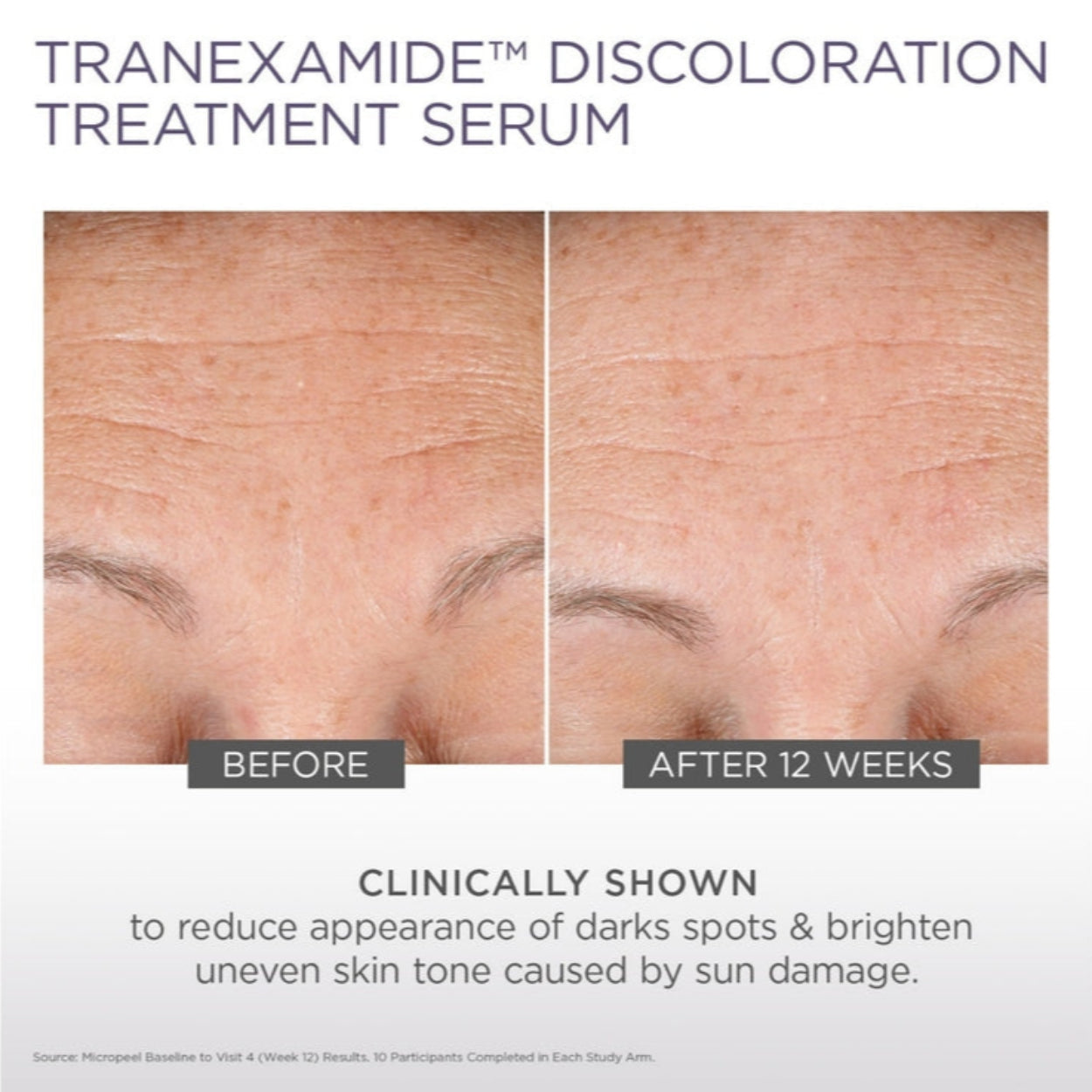 TranEXamide_Discoloration_Treatment_Serum Image 3