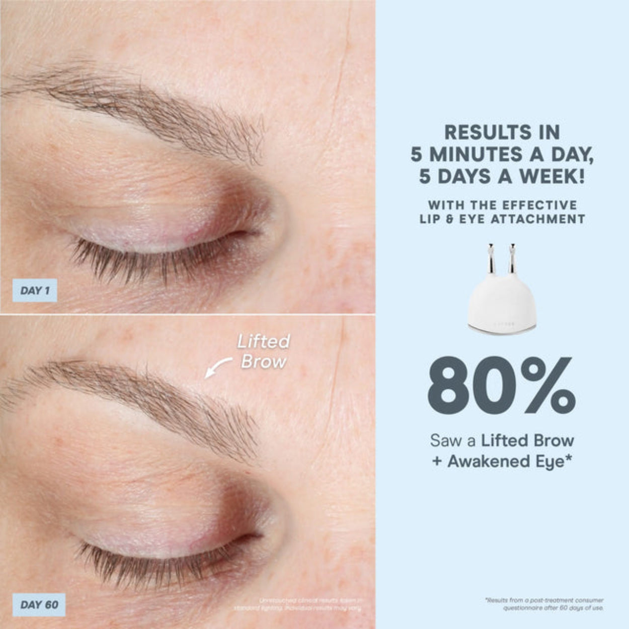 Trinity ELE Attachment (Effective Lip and Eye) Image 4
