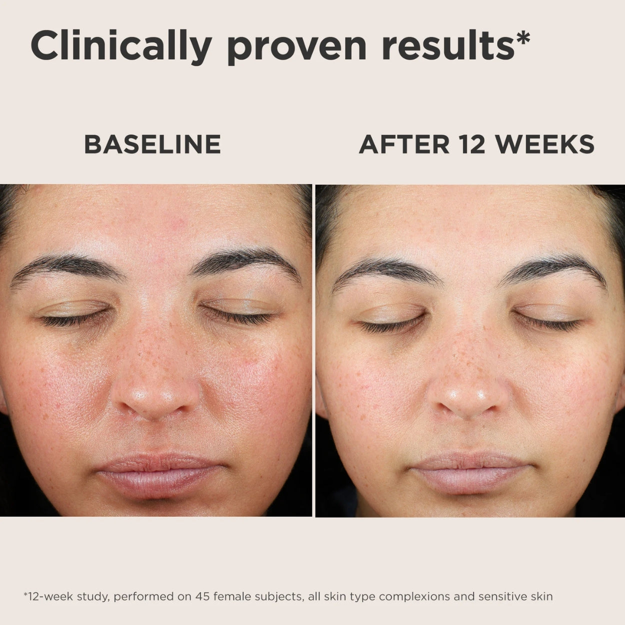 UV Skin Recovery Broad Spectrum SPF 50 Face Sunscreen before after Image 