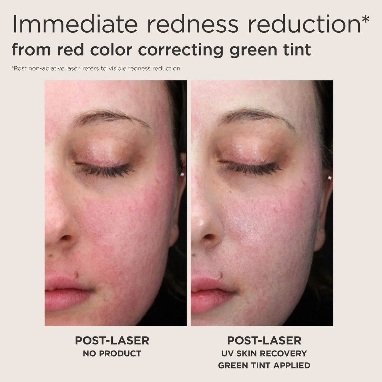 UV Skin Recovery Green Tint SPF 50 before after Image 2