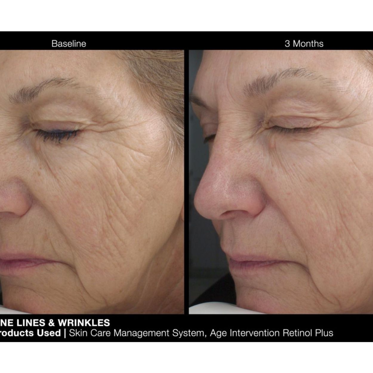 Age Intervention Retinol Plus Face Cream