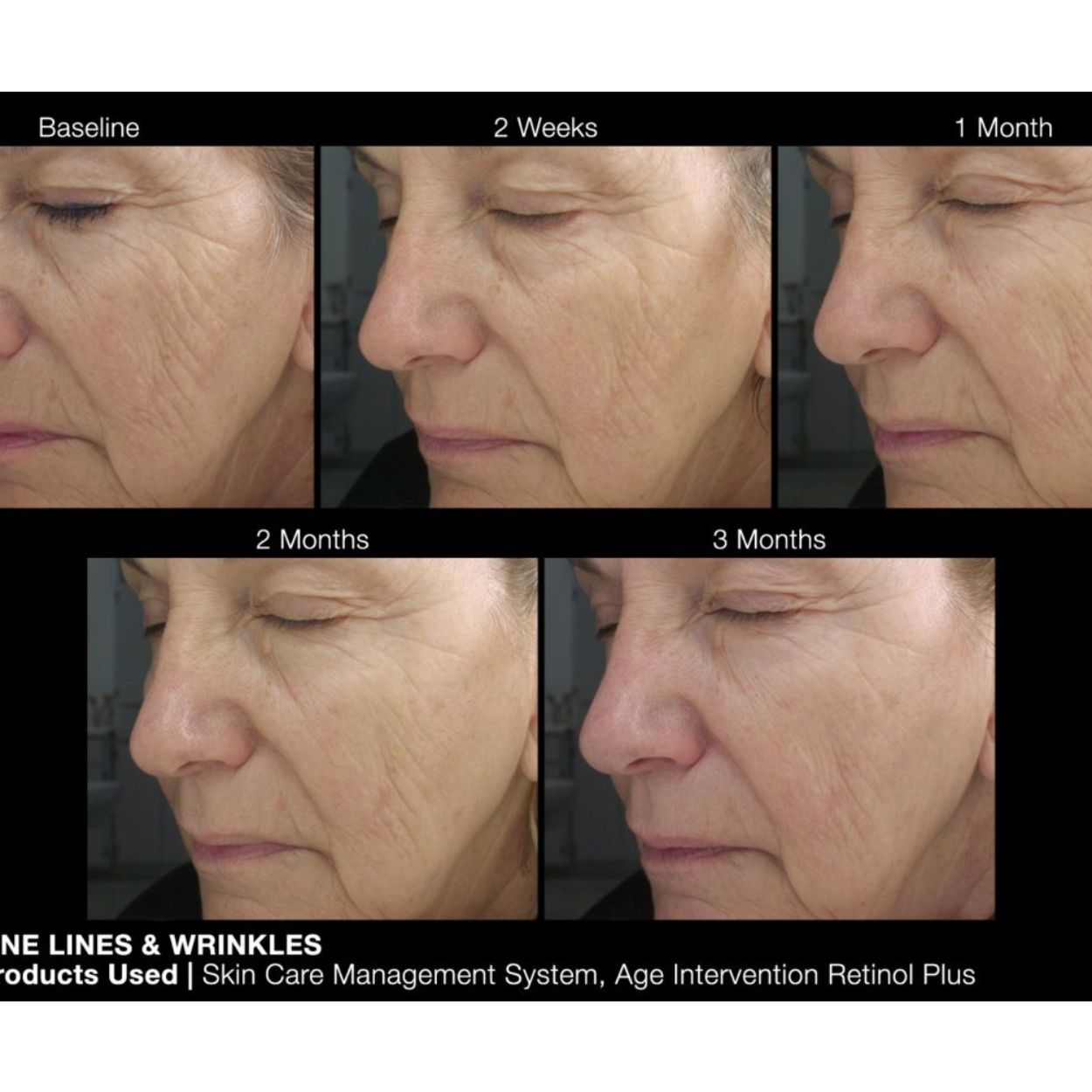 Age Intervention Retinol Plus Face Cream