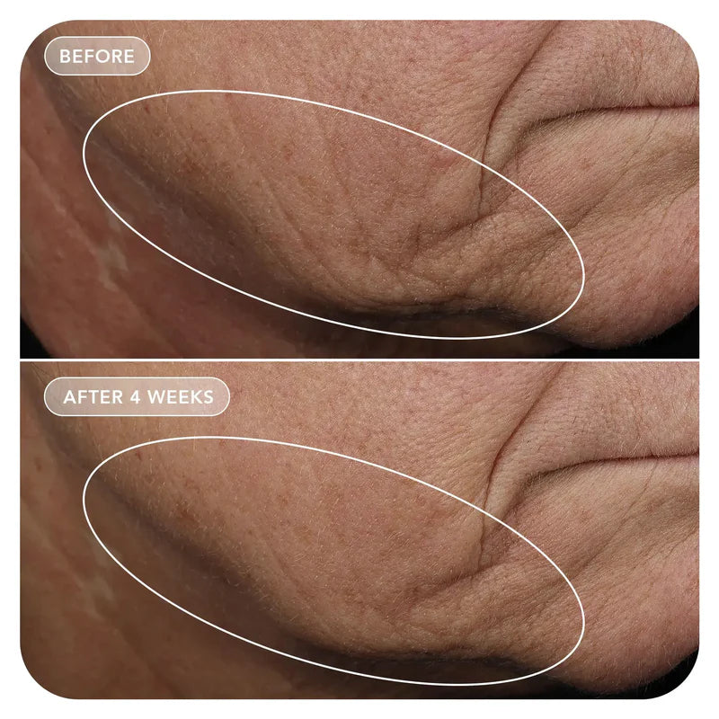 VOL.U.LIFT™ GLP-1 4D Skin Rebound Complex Model Image 2
