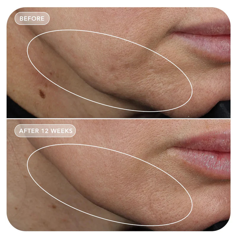 VOL.U.LIFT™ GLP-1 4D Skin Rebound Complex Model Image 3