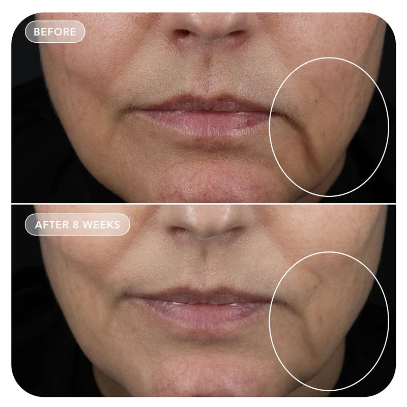 VOL.U.LIFT™ GLP-1 4D Skin Rebound Complex Model Image 5