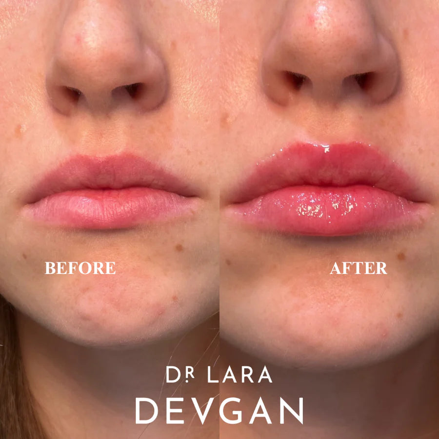 Vermillion Lip Plump Model Image