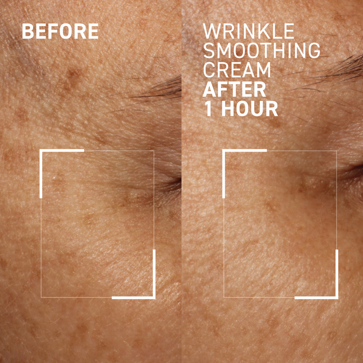 Needles No More Wrinkle Smoothing Cream