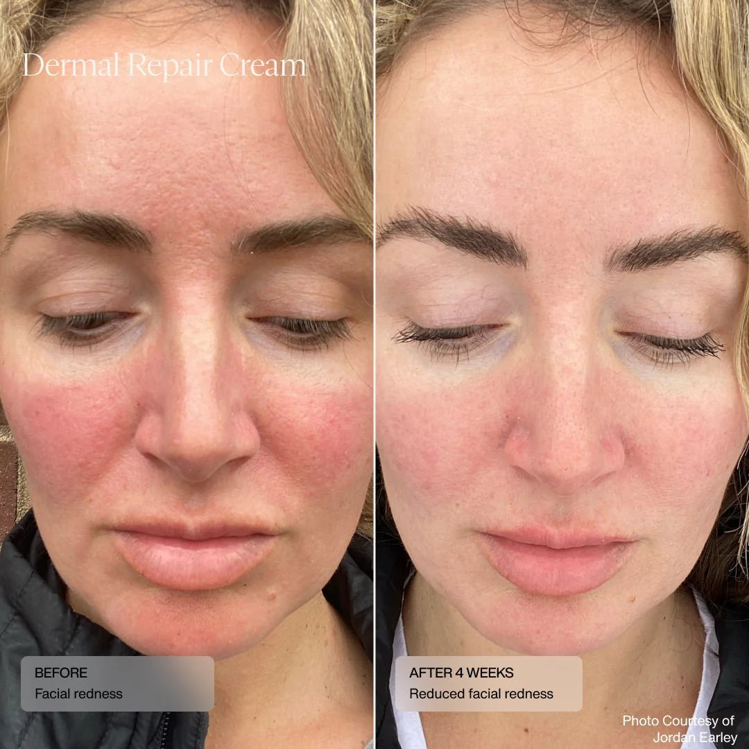 Draft - Dermal Repair Cream Treat